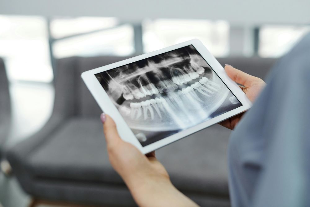 Dental X Rays in Lewisham