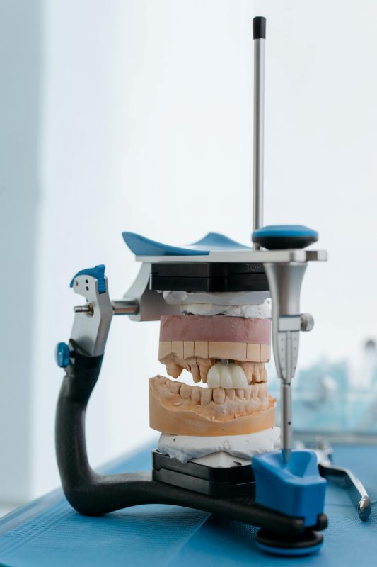 Why Dental Bridges Matter