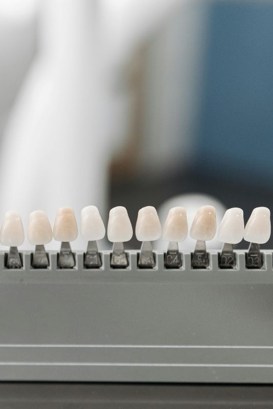 Why White Fillings Matter